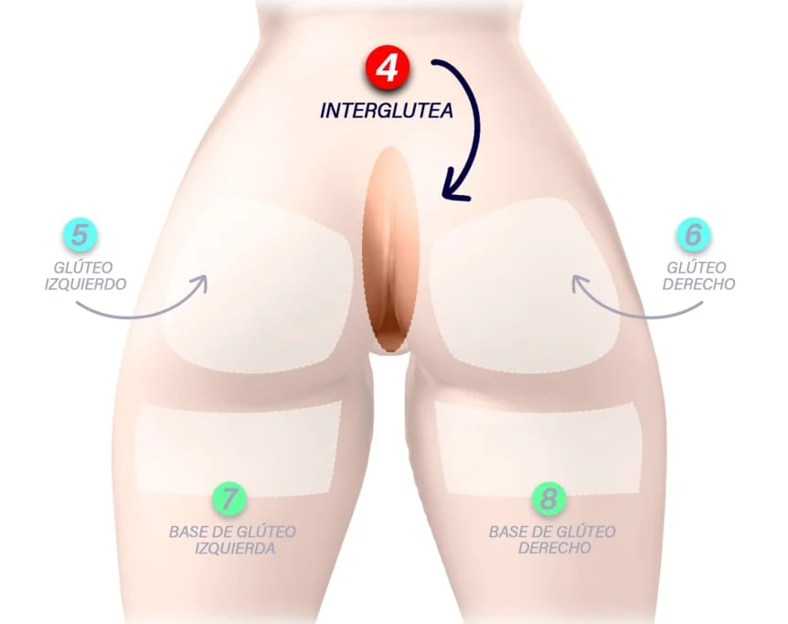 Diagrama de la zona 4, Interglútea