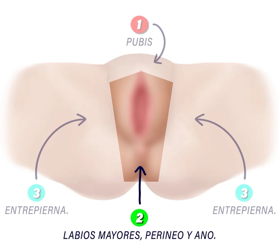 Diagrama de la zona 2, Labios mayores, perineo y ano