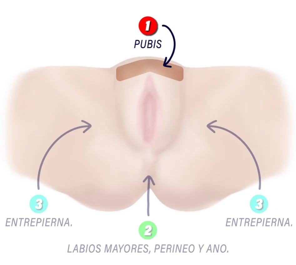 Diagrama de la zona 1, Pubis